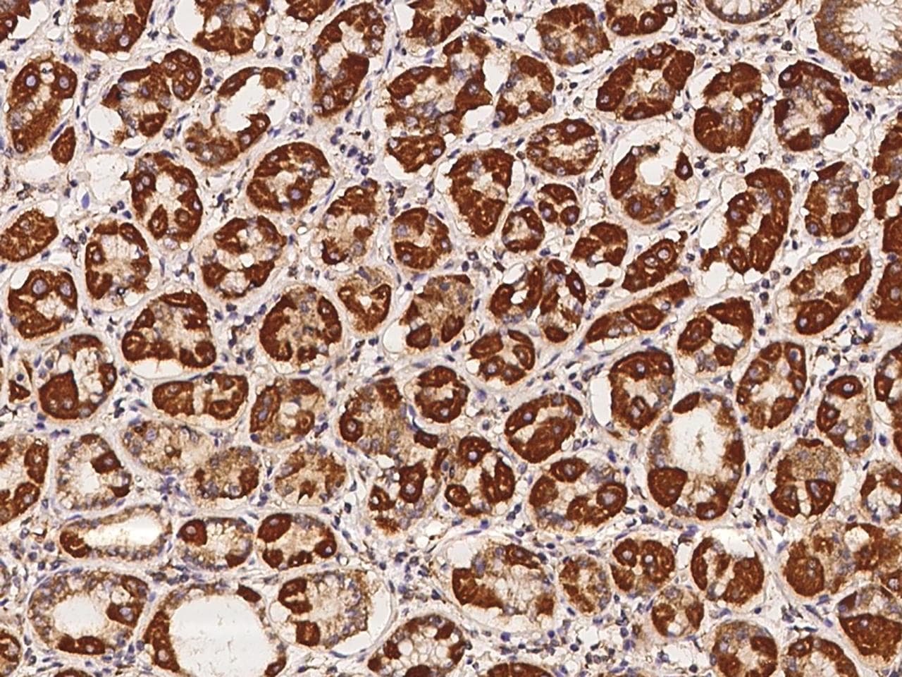 TMEM65 Antibody