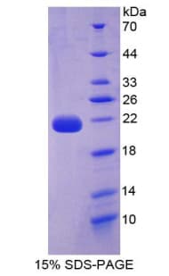 Human IL22 Protein (Recombinant His-T7)