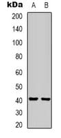 Monoclonal Mouse anti-Mouse HAO1 Antibody (WB)