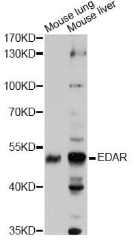 Polyclonal Rabbit anti-Human EDAR Antibody (WB)