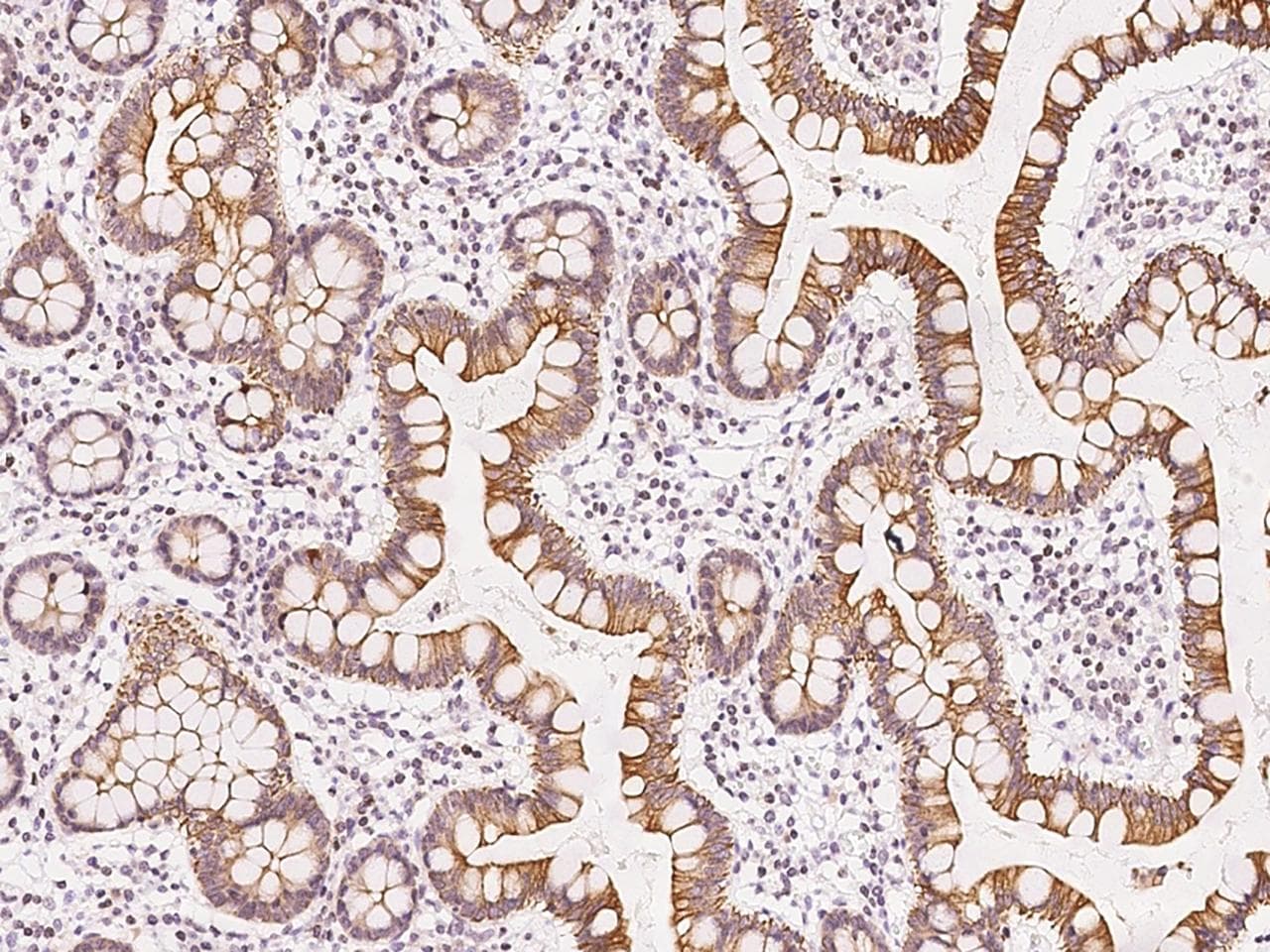 DPCR1 Antibody