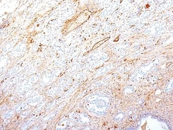FN1 / Fibronectin Antibody (clone SPM246)