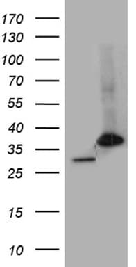 PSMA7 Antibody (clone OTI5F6)