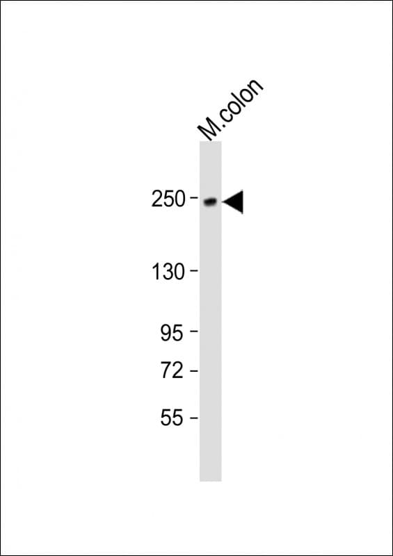SMMHC / MYH11 Antibody (aa21-56)
