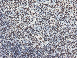 NONO / P54NRB Antibody (clone OTI2C9)