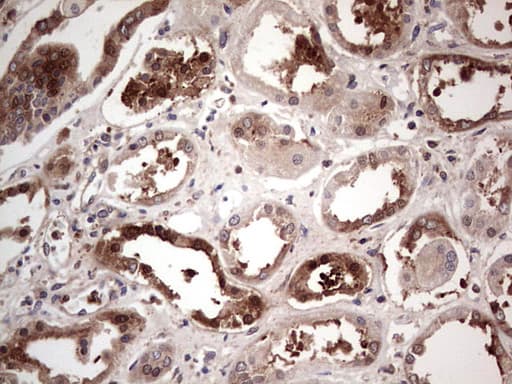 Monoclonal Mouse anti-Human PKM2 Antibody (clone 1F12, IHC, WB)