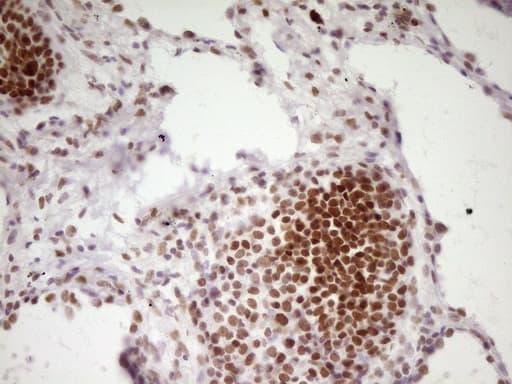 HMG20A Antibody (aa1-281, clone OTI2H4)