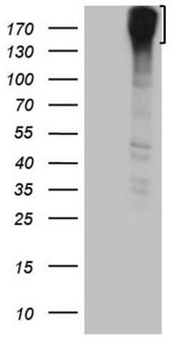 Monoclonal Mouse anti-Human ROS1 / ROS Antibody (clone OTI1E6, aa2126-2347, IHC, WB)