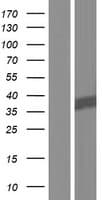 NIT1 Protein (Over-Expression Lysate Myc-DDK (Flag))