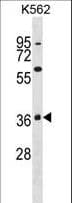 MAPK11 / SAPK2 / p38 Beta Antibody (aa334-359)
