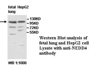 Polyclonal Rabbit anti-Human NEDD4 Antibody (aa634-878, IHC, WB)