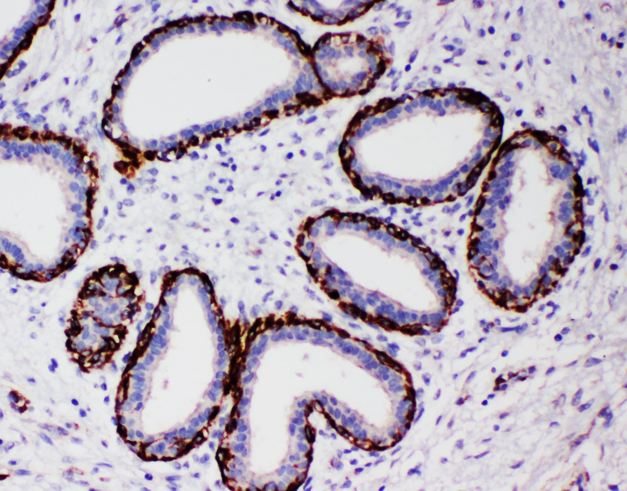 ARG2 / Arginase 2 Antibody (aa67-85)
