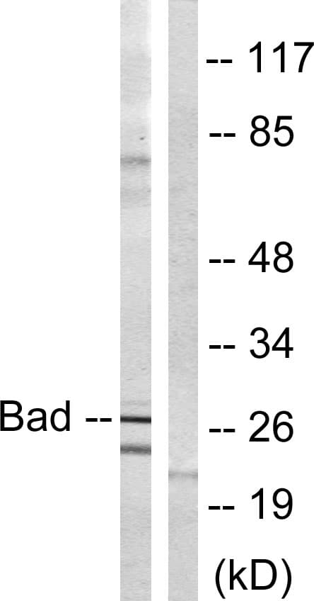 Polyclonal Rabbit anti-Human BAD Antibody (aa100-149, IHC, WB)