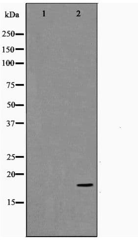 TP53I11 / PIG11 Antibody