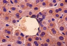 GDF5 / GDF-5 Antibody