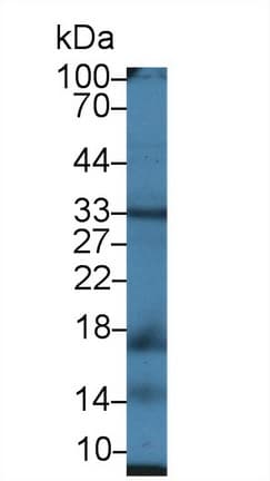 UCP2 Antibody (aa150-304, PE)