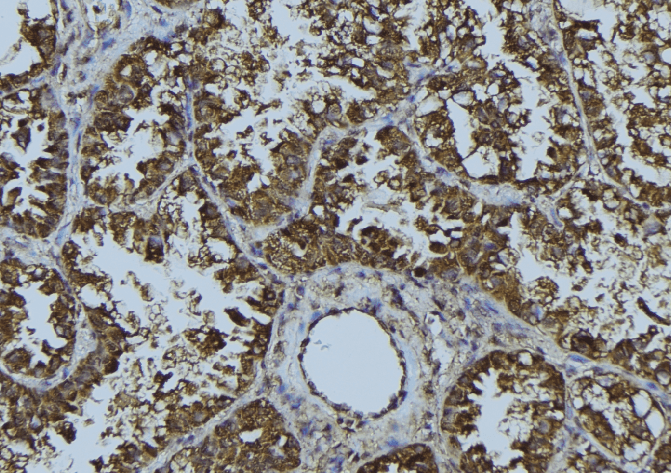 SIRT3 / Sirtuin 3 Antibody
