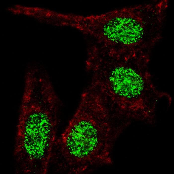 KLF4 Antibody (Ser457)