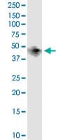 Monoclonal Mouse anti-Human BCAT1 / ECA39 Antibody (clone 1F8, WB)