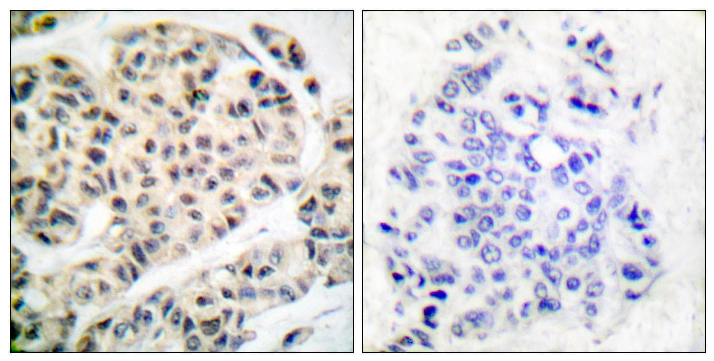 MEF2A / MEF2 Antibody (phospho-Thr319)