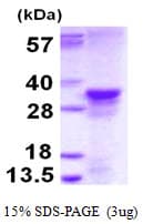 Human MRGBP Protein (Recombinant His)
