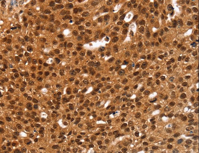 Polyclonal Rabbit anti-Human CARP / ANKRD1 Antibody (IHC, WB)