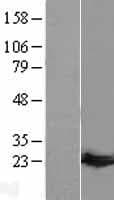 GUK1 / Guanylate Kinase 1 Protein (Over-Expression Lysate Myc-DDK (Flag))