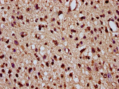 Polyclonal Rabbit anti-Human HIST1H2BN Antibody (IHC, WB)