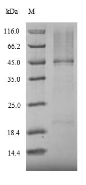 Mouse RORC / ROR Gamma Protein (Recombinant 6His, N-terminus)