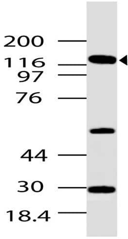 GLI / GLI1 Antibody (aa881-1000)