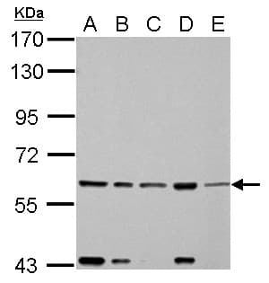 Polyclonal Rabbit anti-Human FASTK / FAST Antibody (aa346-549, IHC, WB)