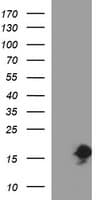 SIVA1 / SIVA Antibody (clone OTI1G8)