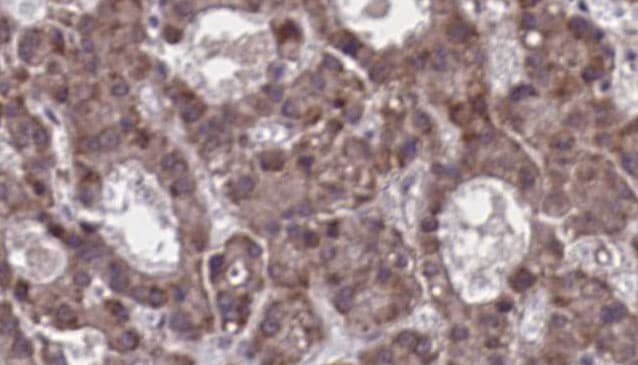 C5AR2 / GPR77 / C5L2 Antibody