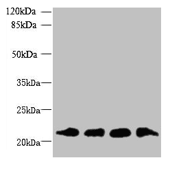 Polyclonal Rabbit anti-Human MRPL18 Antibody (IHC, WB)