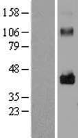 LRRC17 Protein (Over-Expression Lysate Myc-DDK (Flag))