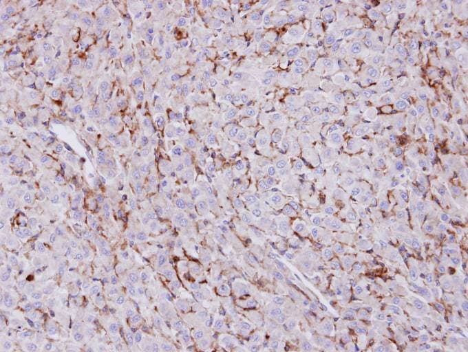 TREH Antibody (aa7-285)