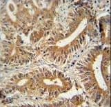 CEP89 Antibody (aa658-687)