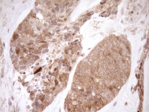 ITPK1 Antibody (aa309-391, clone OTI1F5, Carrier-free)