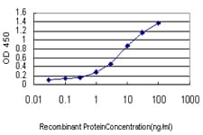 IHC-plus™ HBB / Hemoglobin Beta Antibody (clone 7B12)