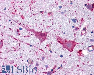 PathPlus™ Polyclonal Rabbit anti-Human GLP1R / GLP-1 Receptor Antibody (N-Terminus, IHC, IF, WB)