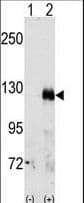 EPHA3 / EPH Receptor A3 Antibody (aa896-928)