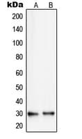 IHC-plus™ RPS8 / Ribosomal Protein S8 Antibody (Internal)