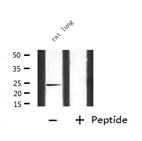 Polyclonal Rabbit anti-Human CDKN3 / KAP Antibody (IHC, IF, WB)