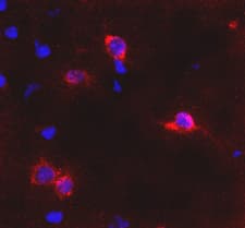GRM6 / MGLUR6 Antibody (aa859-871)