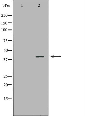 Polyclonal Rabbit anti-Human NR1I3 / CAR Antibody (IHC, IF, WB)