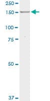 PathPlus™ MPO / Myeloperoxidase Antibody (clone 3E11)