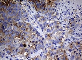 NME1 / NM23 Antibody (clone OTI4G3, Carrier-free)