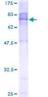 Human CCT8L2 Protein (Recombinant GST)