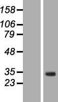 ACRV1/Intra-Acrosomal Protein (Over-Expression Lysate Myc-DDK (Flag))