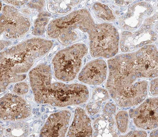 GCP3 / TUBGCP3 Antibody